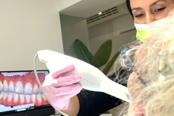 clinica dental nunez cobos escaner intraoral